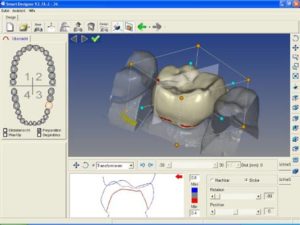 Cad Cam Dentistry